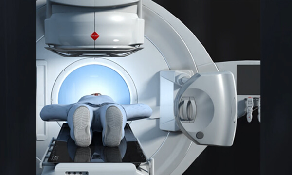 6D Patient Positioning With I-Guard System 